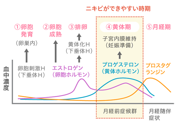 生理前に肌荒れ ニキビができる原因 対処方法 あいび公式オンラインショップ